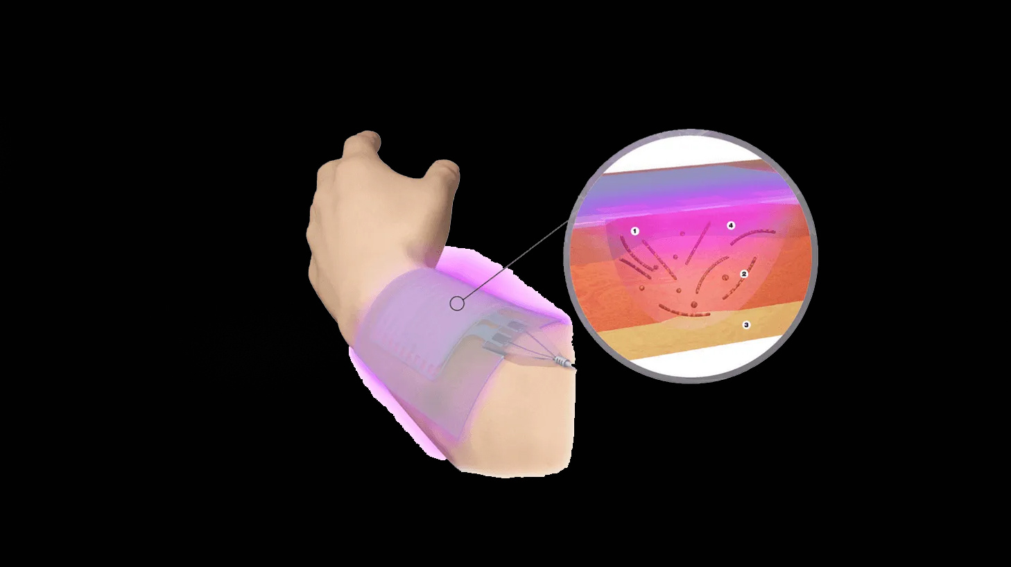 Arm mit COLDPLASMATECH-Patch