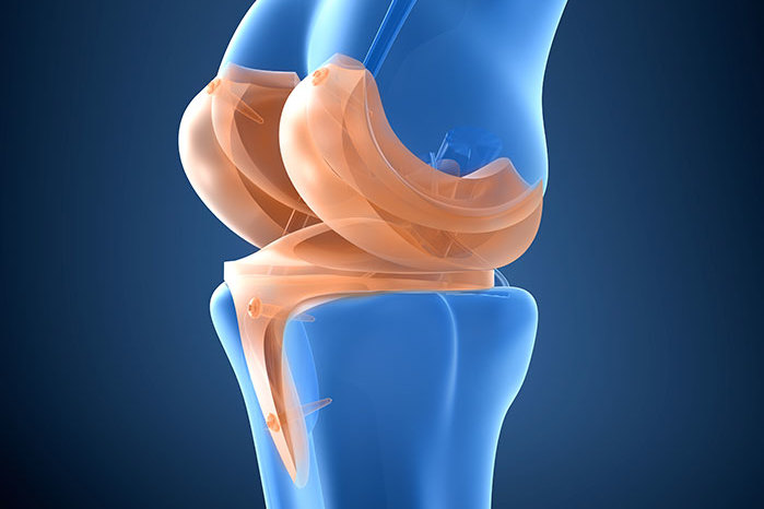 Knieprothese: künstliches Kniegelenk - Reha und OP